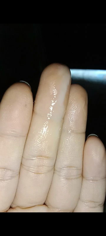 สอบถามแม่ๆหน่อยค่ะท้องได้36+2วันแล้วค่ะ แอบกลัวๆว่าจะคลอดเพราะยุคนเดียว