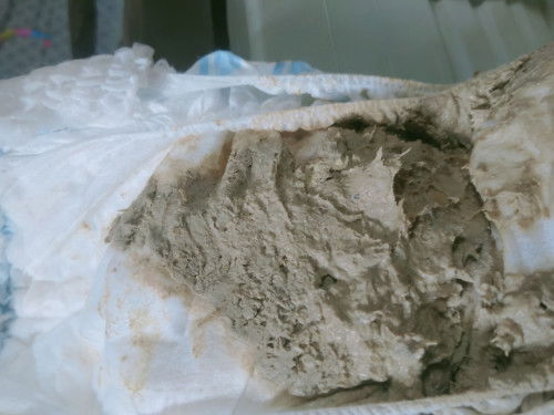 Normal Lang poba na gantong kulay Ng poops one year old na po si baby