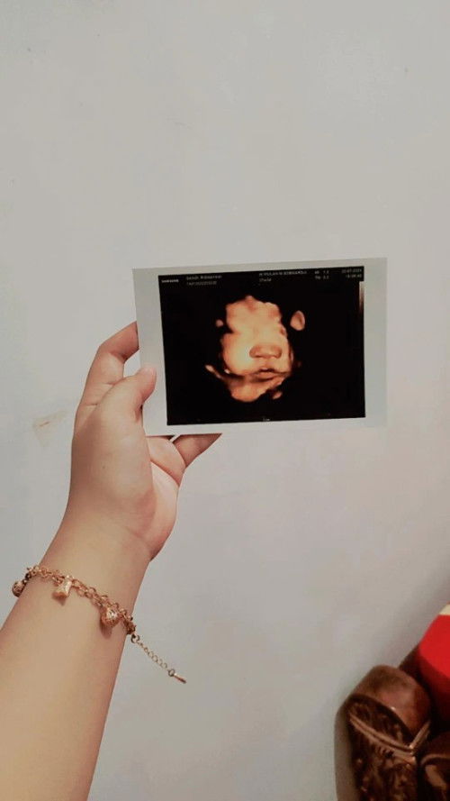 bismillah bunda mohon do'anya ya...