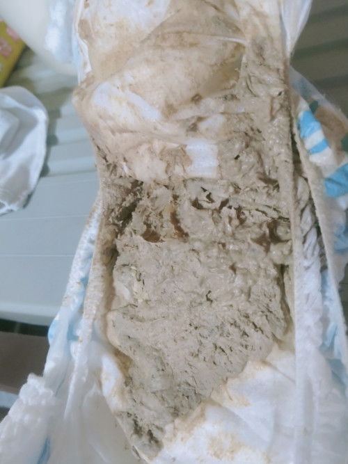 Normal Lang poba ang gantong color ng poops ni baby stop breastfeeding na po ako