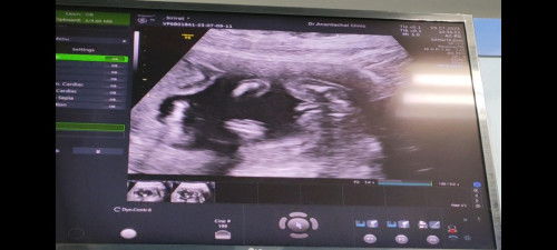 แบบนี้ได้ผช.มั้ยค่ะ