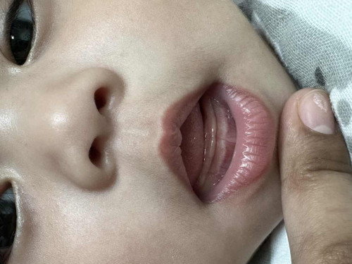 Baby Teething