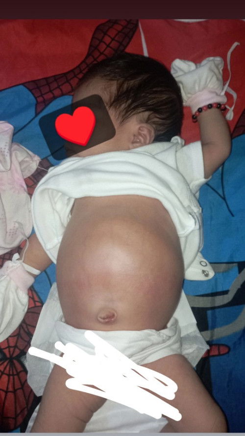 Hello po ask lang po normal po ba ganitong chan sa 10 days na baby