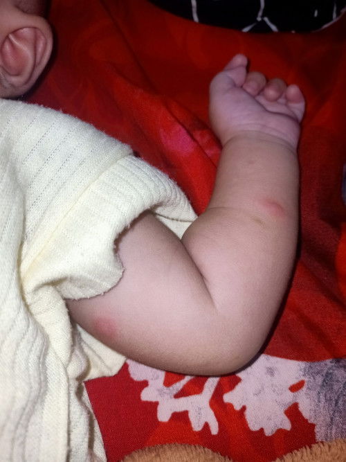 Ada yang tau gak ya bunda?