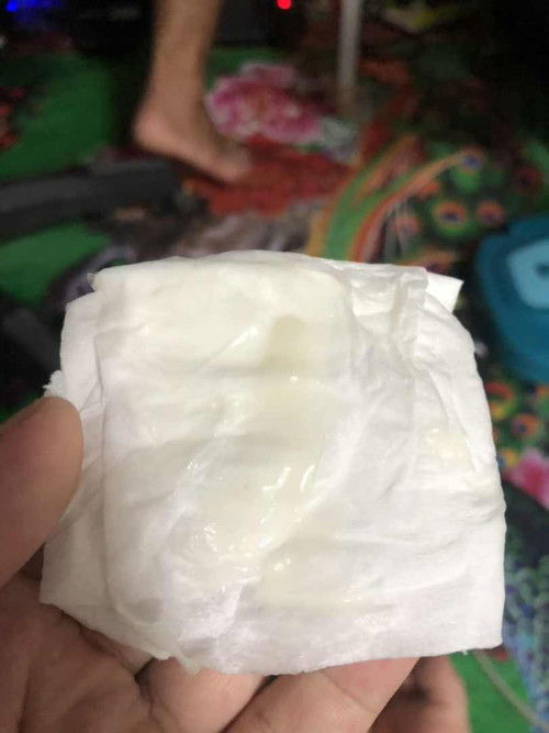 อันนี้มูกหรือตกขาวค่ะ พอดีมันออกมาเยอะ