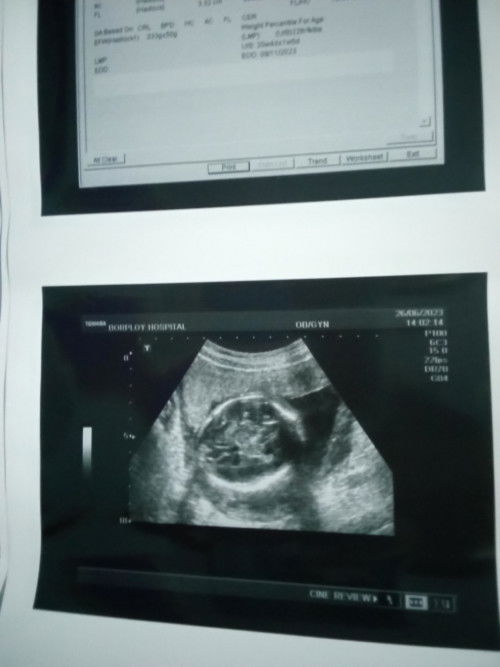 ขอถามหน่อยค่ะผู้หญิงผู้ชายค่ะ