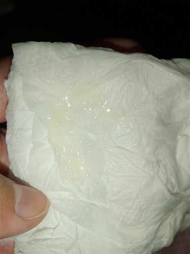 สัญญาณเตือนใกล้คลอดแล้ว มีมูกออกทางช่องคลอด ท้องที่2ก็เคยเป็นแบบนี้ไม่เกิน5วันก็คลอด