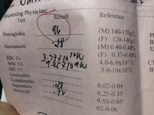 Mababang hemoglobin