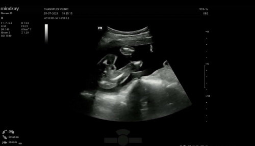 แม่ๆธีมธันวา66 รู้เพศลูกกันยังค่ะ