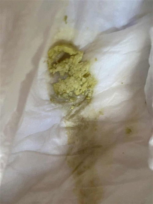 nak taw pasaipa najis anak saya mcm ni ada yg taw dk