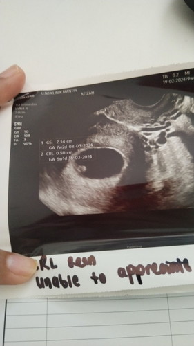 Nak tahu pengalaman mommy?