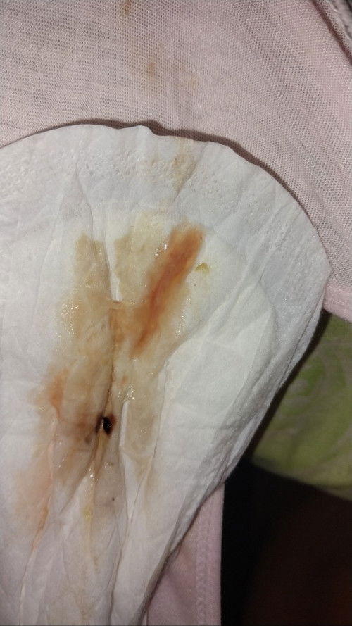 Bunda2 mau tanya,klo ngflek lndir cmpur darah gini biasanya terjadi berapa hari ya??