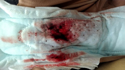 Apakah karna hormon yg tidak seimbang?