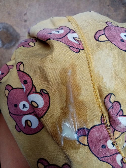 แบบนี้เขาเลือกว่าอะไรคะแม่ๆ
#ควรไปหาหมอรึเปล่า​ 37+1w