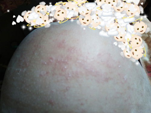 Gatel parah d area perut