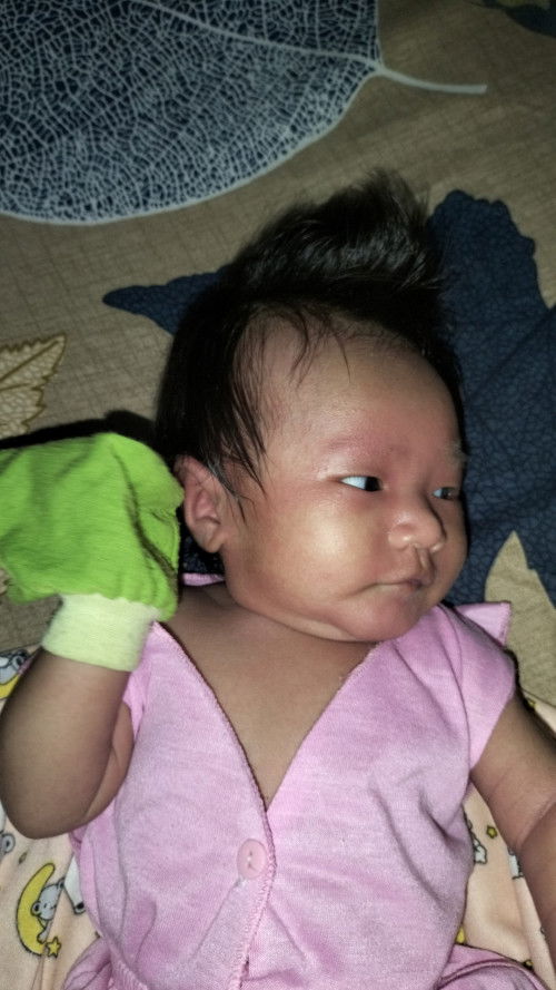 Muka Bayi ku merah