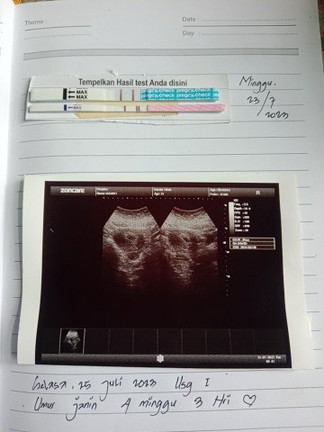 Hpht tgl 13 juni,dan alhamdulilah udh masuk 5 minggu tespeck alhamdulilah gris 2 🥰