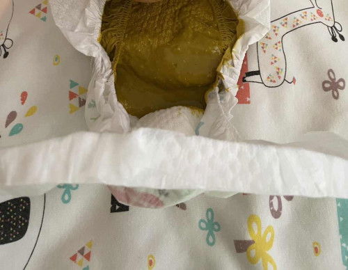 Is this normal poop?