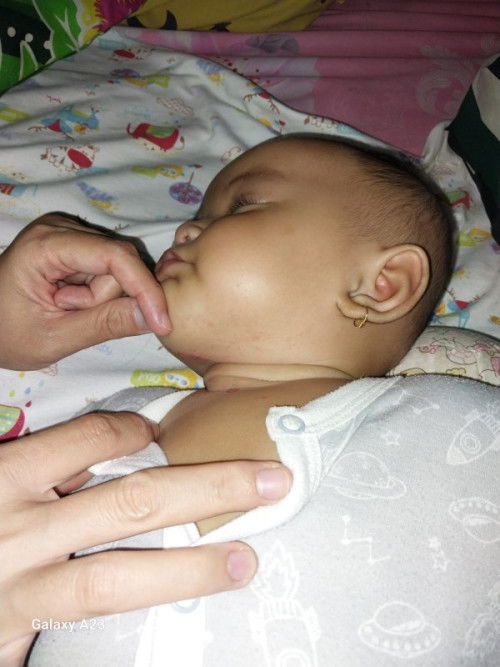 Ini bintik merah cacar air atau biang keringat