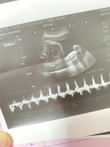 30w ท้องแรกลูกสาว