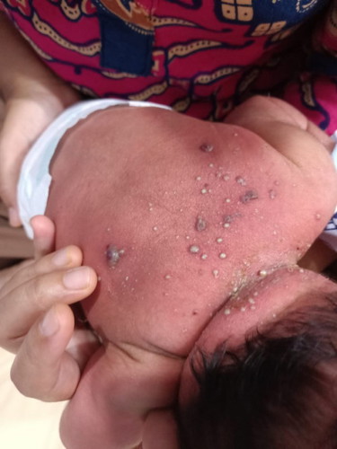 Solusi obat