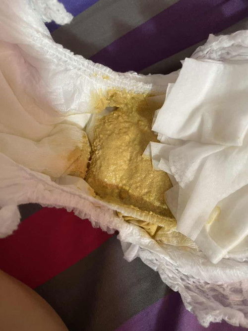 ลูกอึแบบที่ผิดปกติไหม