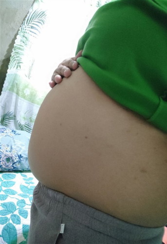 Big baby bump
I'm 16 weeks and 4 days pregnant. Masyado po bang malaki ang tummy ko? I'm 73 kgs.