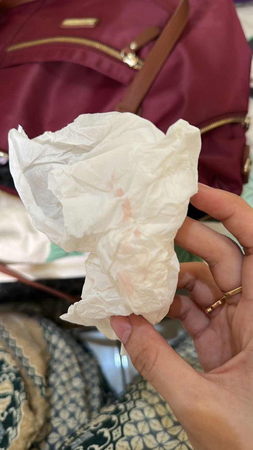 Keluar bercak darah pagi ini dan kontraksi yang hilang timbul