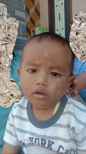 Tentang kulit si kecil