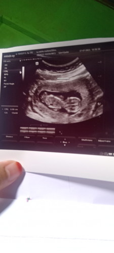 Kan tadi saya USG apakah 12 Minggu 6 hari panjang 6,8 normal ya bund. ,saya sering minum es soalnya