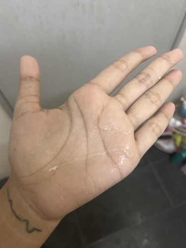 ตั้งครรภ์มีมูกออก