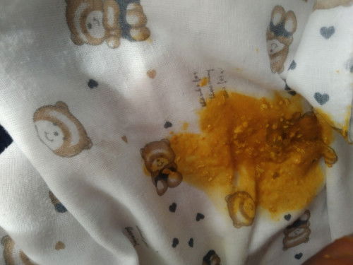 สอบถามแม่ๆค่ะอึแบบนี้ท้องเสียมั้ยคะ