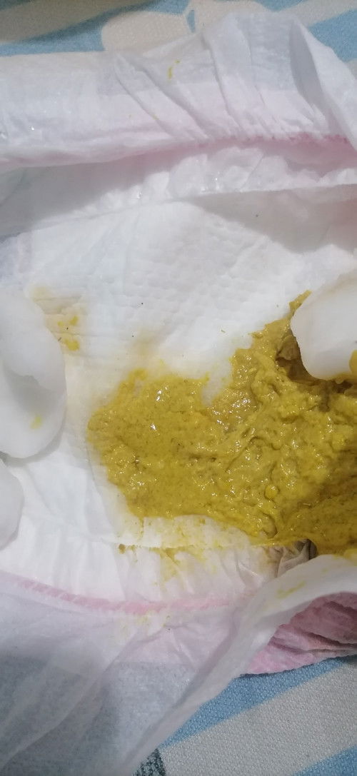 Formula fed normal po ba ito