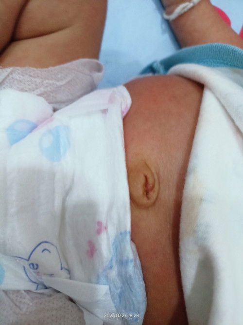 สะดื้อลูกน้อย