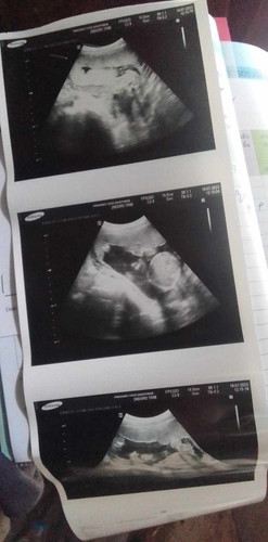 21w แม่ๆบ้านอื่นท้องใหญ่มากมั้ยคะ กังวนมากค่ะ