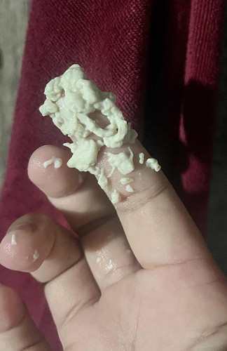 ตกขาวเป็นแป้ง