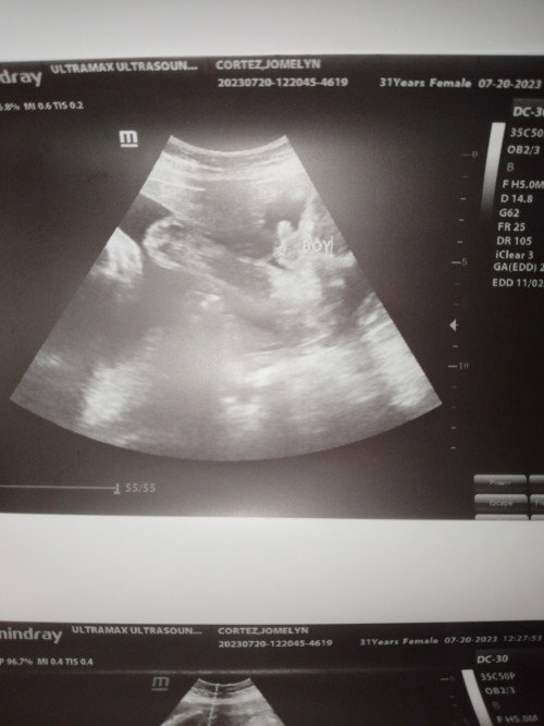 Sure na po kaya na boy si baby? 😊😊