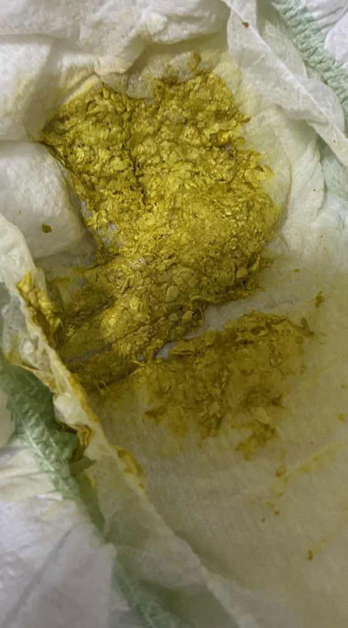 Poops baby concern. Formula milk po siya