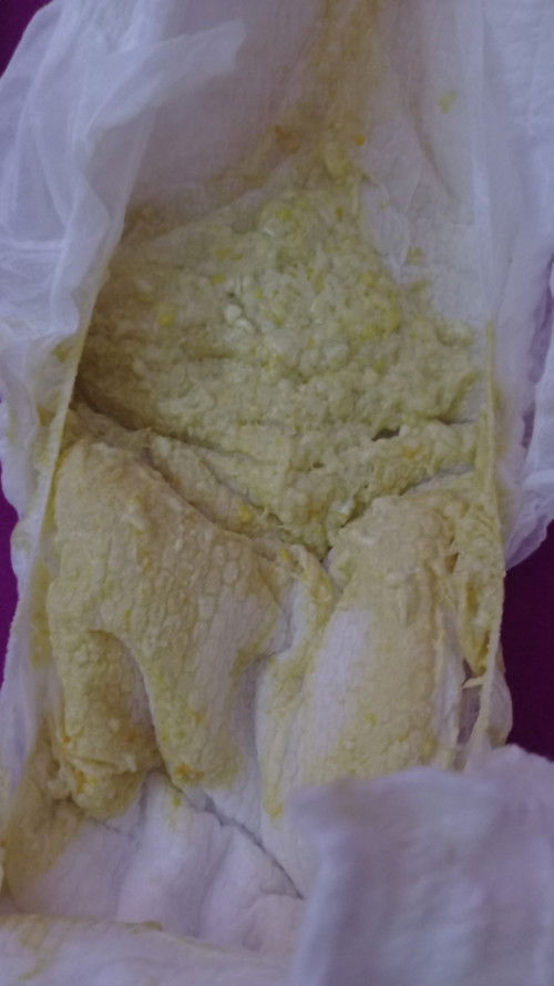 Apakah normal feses bayi berwarna ini?