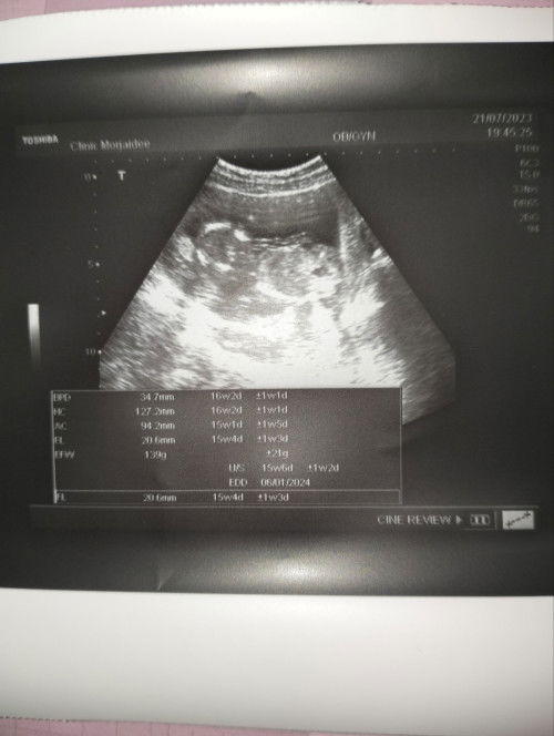 15week4วันดูน้ำหนักลูกตรงไหนคะ