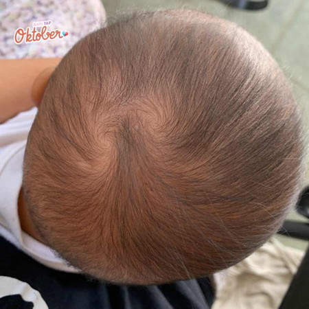 BABY 2 PUSAR DI KEPALA