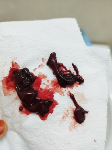 Keguguran dan apa perlu saya buat?