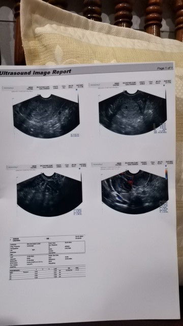 ดีค่ะอายุครรภ์5w