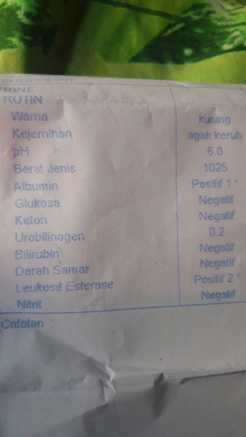 Bun ada yg pahamkah hasil cek lab urin ini,,aku tensi 136/90
Hasil urin nya ini