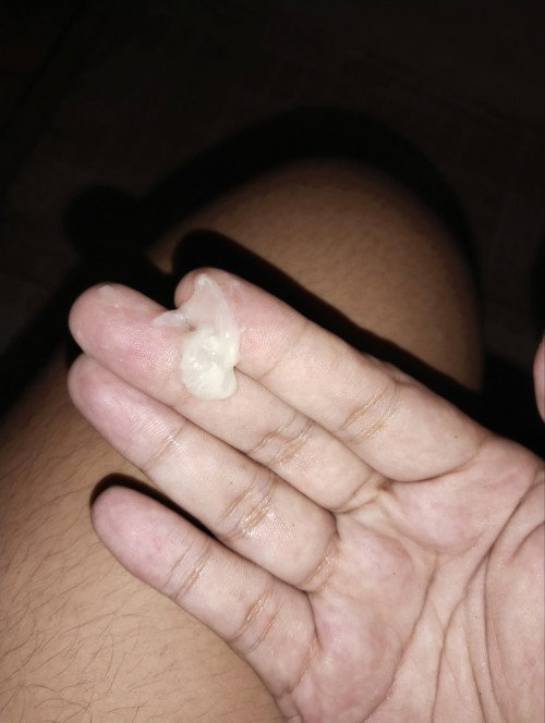 Mga mi ano kaya tong lumabas saakin ?