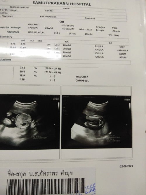 แม่ๆดูออกกันไหมคะว่าเพศหญิงหริอเพศชาย