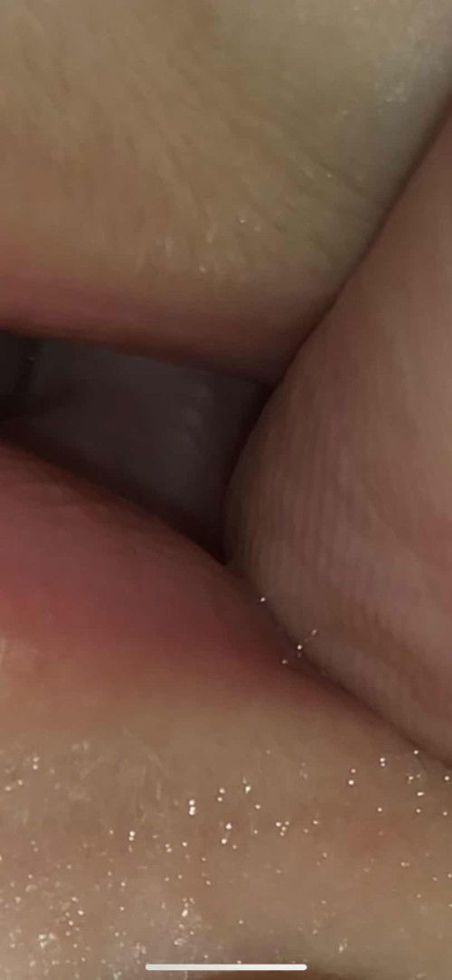 Pertumbuhan gigi bayi