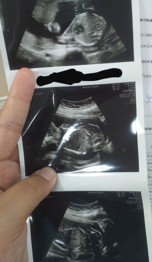 ช/ญกันแน่คะ