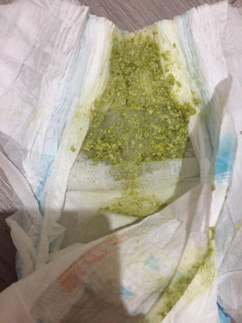 green poop ni baby