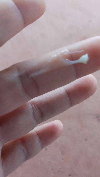 ตั้งครรภ์ได้6สัปดาห์แล้วมีมูกแบบนี้ออกจากช่องคลอดเขาเรียกอะไรค่ะอันตรายไหมค่ะสอบถามแม่ๆหน่อยค่ะ